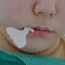 호호치과기공소 이미지