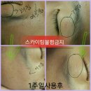 O2 테라피 이미지