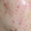 클린업피부과의원 이미지