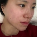 수원-0636 | 수원 영통 I 모데이왁싱 영통점에서(영통왁싱) 페이스왁싱 후기