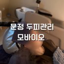 GS25 길동하이브점 | 잠실 여자탈모관리! 지루성 두피염 관리후기 [모바이오]송파문정점