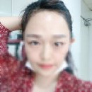 압구정동헤어라인 | 여자 M자이마 2800모 절개 헤어라인교정수술 5년 찐후기(인생 TOP3 인정)