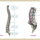 허리디스크... 이미지