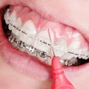 원주치과의원 이미지