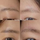 스테이 무아 | 인천 눈썹문신제거 붉은색 잔흔 색소 4회차 후기 송도 스테이무아