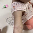 경희한나무한의원 | 돌 아기 아토피 치료 경희신창한의원 다녀온 한 달 후기 윤피청 한약 내 돈 내산