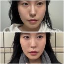 이브닝 셀프 동안 페이스 요가 | 닥터빼 브이핏패치 사용 후기 : 취침 전 간단하게 하는 얼굴윤곽관리 루틴