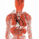 당신의 혈관이 깨끗해야 하는 이유 이미지