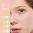 네이처성형외과의원 | 가로목주름 어떻게 없앨 수 있을까?