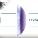 비전옵틱스 이미지