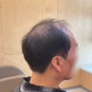 대구중앙 | 대구가발 퀄리티가 남다른 박승철위그스튜디오 대구중앙점 후기