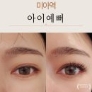 아이예뻐 - 북구 | 미아역속눈썹연장 아이예뻐 11JC 플랫모 자연스럽게 예뻐진 후기