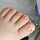 역곡신발 | [뷰티 일기] 친구의 문제성 발관리 해결해주기!! 페디프로 부천역곡점에 다녀온 후기