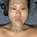 군산피부관리,피코토닝+크레이지+물방울리프팅 &#34;보금뷰티&#34;