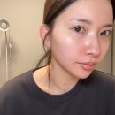 수영센텀피부과의원 | 부산수영근처 야간진료 피부과, 피부결 모공관리 포텐자 내돈내산 후기