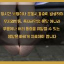 평발 교정과 평발 치료 이미지