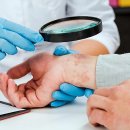 고운한의원 | 여름철 얄미운 두드러기, 저의 솔직한 경험담과 한의원 방문 후기 보여드릴게요!