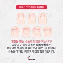 나도손톱 레푸스 개봉점 이미지