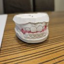 가온치과병원 | 초등 부정교합 교정 후기 | 주걱턱 반대교합 교정 과정 (천안 어린이 치과 추천, 가온치과)