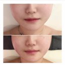 끌리메 | 창원 에스티틱 [끌리메 창원점] 끌링관리 받고 온 리얼 후기