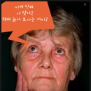 지니옵틱 | 인공수정체(비비티) 수술 후기 (웃픔주의)