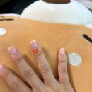 예손한의원 | 예손병원 사구체종양 수술 후기 1탄