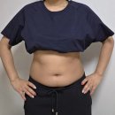 청산서울의원 | 상상하던 핏을 찾아줄 지방분해주사의원 1회차 방문후기