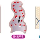 미래외과 네이버블로그