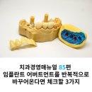 올어버트먼트 치과기공소 이미지
