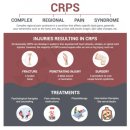 악마의 통증! 복합 부위 통증 증후군 (CRPS)