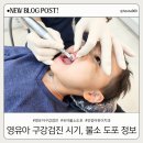 흑석임치과의원 | 영유아 구강검진 시기 4살 아이 불소 도포 후기
