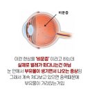 눈플러스안경원 이미지