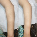 채영에스테틱 네이버블로그