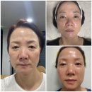 오아이씨 | “오아이씨 247 파워풀팩 사용후기, 단 6일, 나를 다시 사랑하게 만든 작은 기적”