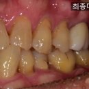 나온치과기공소 이미지