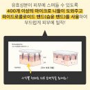 팔자주름 목주름 눈밑 주름 패치 캐럿티카 아임필패치 4pack) -21500원에 판매 이미지