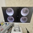 조은소리보청기 이미지