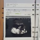 임신일기: 18-26주 일상 및 정밀초음파, 임당검사 후기(천안 퀸스산부인과 서기원 원장님)