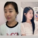 오늘,맑음의원 네이버블로그