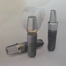 엠에스(MS)치과기공소 | 임플란트 시술을 한 경우 치간칫솔이 꼭 필요한 이유와 치간칫솔 선택 및 사용방법