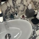 강남세련성형외과의원 | 강남성형외과 어깨필러후기직각어깨 전후 비교 리얼 변화