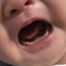 아이언소아청소년과의원 이미지