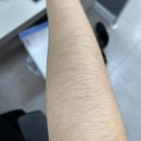 리앤디스코 | [체험단] 산본바디왁싱 '리앤디스코 리왁싱' 털털한 팔 왁싱 후기