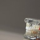 시온의빛치과교정과치과의원 | 제 고민 끝! 치아교정 시작했어요 feat. 대전 둔산동 치과 이야기