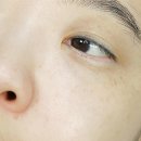 기미랑바비랑 | 성형시술어플 추천 바비톡 강남언니 토닝레이저 알아본 후기