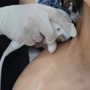 &#39;윤메디테라피&#39;에 하이퍼소닉 관리 받으러 다녀왔어요!