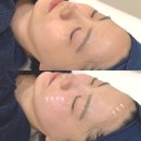 이터널블루 | 온천장피부관리 &#34;이터널스킨&#34; 재방문 &amp; 슈퍼젝션 블루 후기 💦