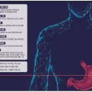 질병 "위염 gastritis" 이미지