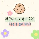 공지로2 | [공지] [자궁내시경 후기 (2)] 수술 후 결과 확인 &amp; 시험관 준비/대구효성병원