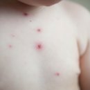 비상메디칼 이미지